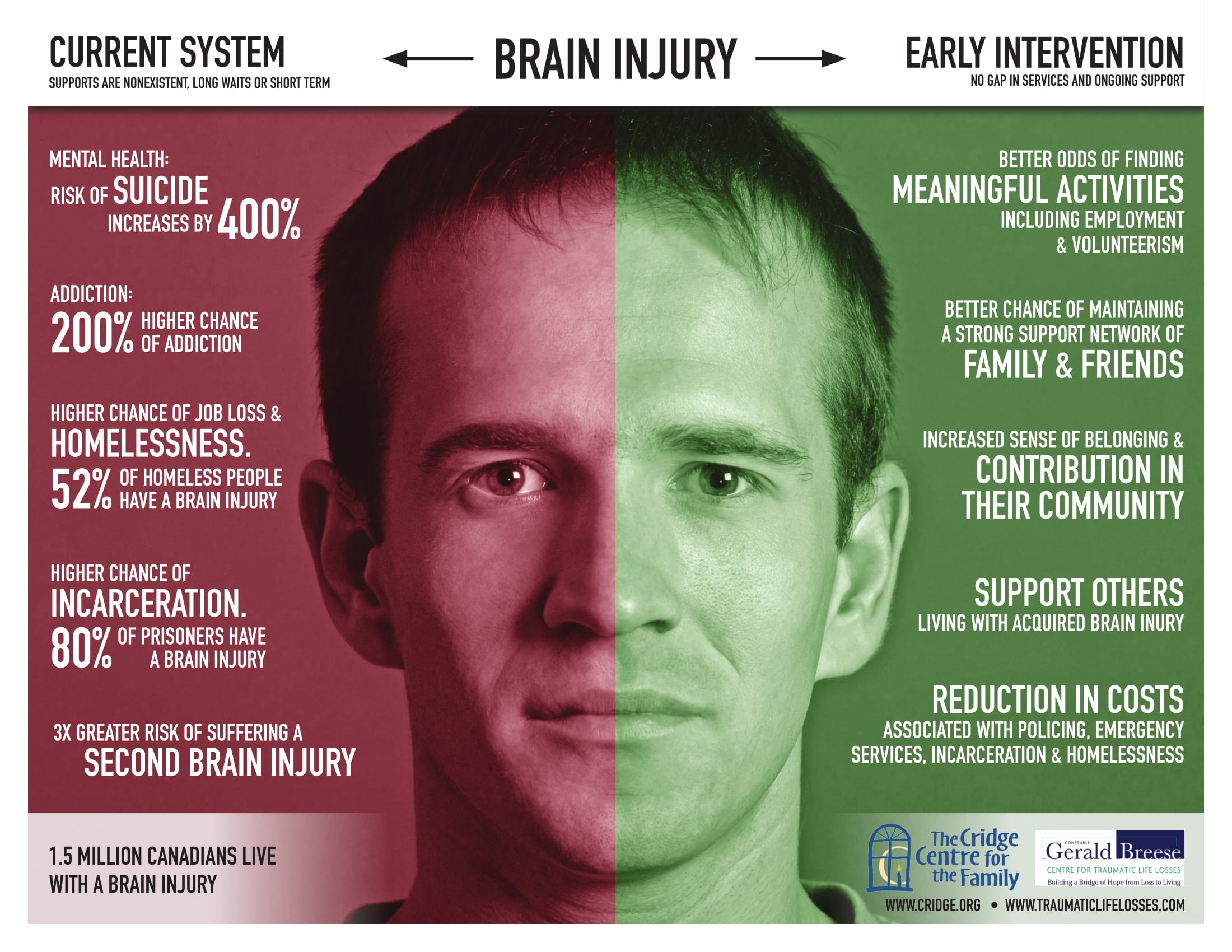 Can Mental Illness Cause Brain Damage